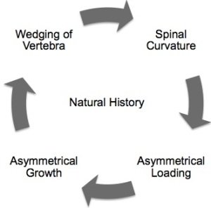 Vicious Cycle | Scoliosis | Hueter Volkmann Principle